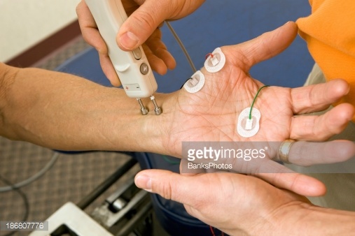 Chiropractor Performing a Median NCV (Nerve Conduction Velocity) Test