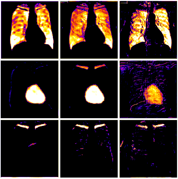 Figure 3. Examples of features extracted after the penultimate upsampling step for All-Dropout (left), All-Convolutional (center) and InvertedNet (right). The same test image was use in all three cases. Higher colour intensities correspond to higher activation values.
